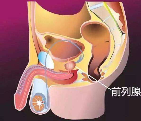 前列腺炎自救康复教程.超有效!